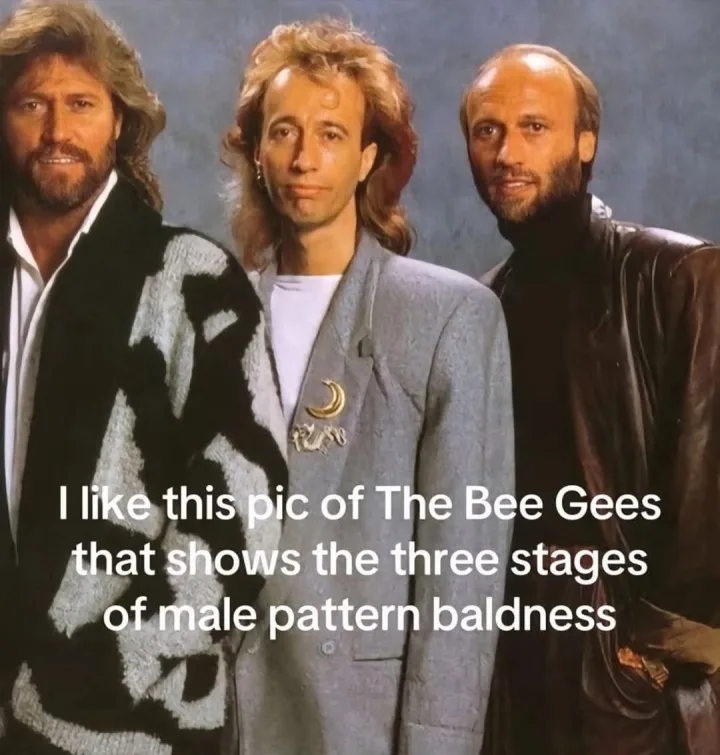 I like this pic of The Bee Gees that shows the three stages of of male pattern baldness